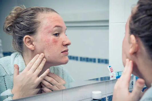 How Long Does a Niacin Flush Last? What to Expect and How to Reduce It